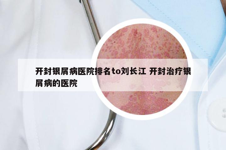 开封银屑病医院排名to刘长江 开封治疗银屑病的医院