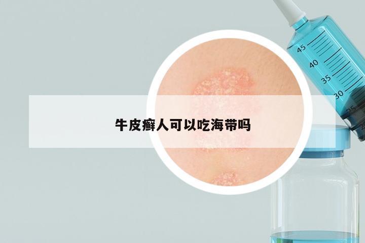 牛皮癣人可以吃海带吗