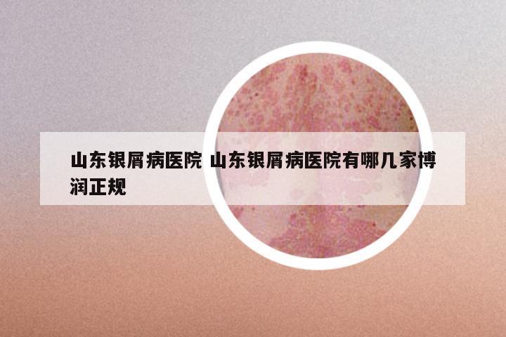 山东银屑病医院 山东银屑病医院有哪几家博润正规