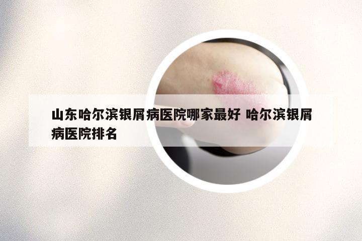 山东哈尔滨银屑病医院哪家最好 哈尔滨银屑病医院排名