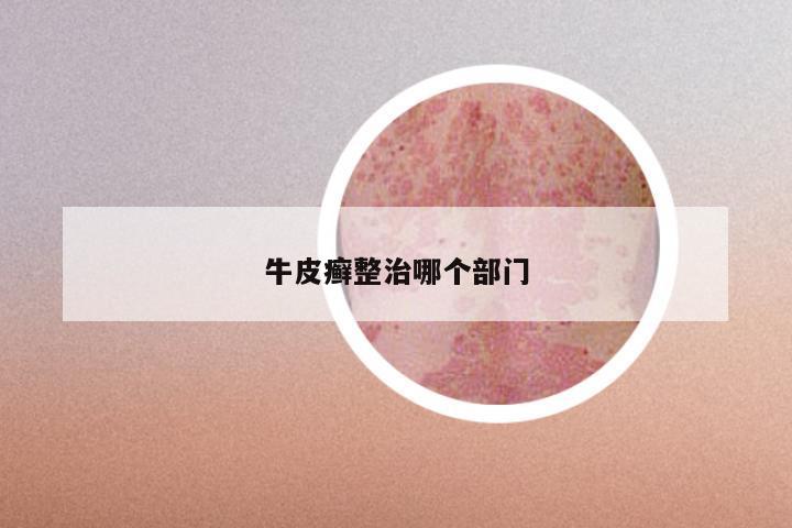牛皮癣整治哪个部门