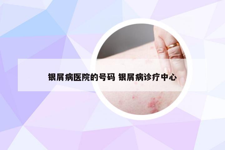 银屑病医院的号码 银屑病诊疗中心