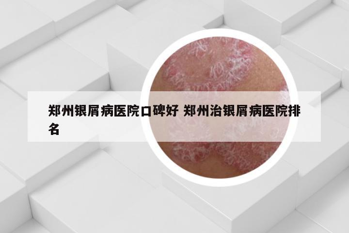 郑州银屑病医院口碑好 郑州治银屑病医院排名