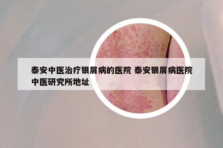 泰安中医治疗银屑病的医院 泰安银屑病医院中医研究所地址