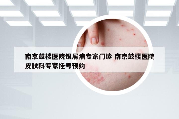 南京鼓楼医院银屑病专家门诊 南京鼓楼医院皮肤科专家挂号预约