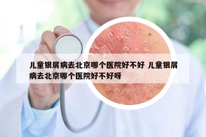 儿童银屑病去北京哪个医院好不好 儿童银屑病去北京哪个医院好不好呀
