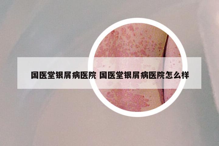 国医堂银屑病医院 国医堂银屑病医院怎么样