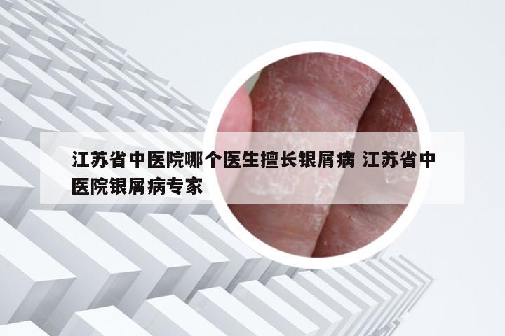 江苏省中医院哪个医生擅长银屑病 江苏省中医院银屑病专家