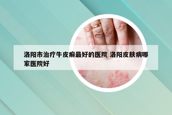 洛阳市治疗牛皮癣最好的医院 洛阳皮肤病哪家医院好