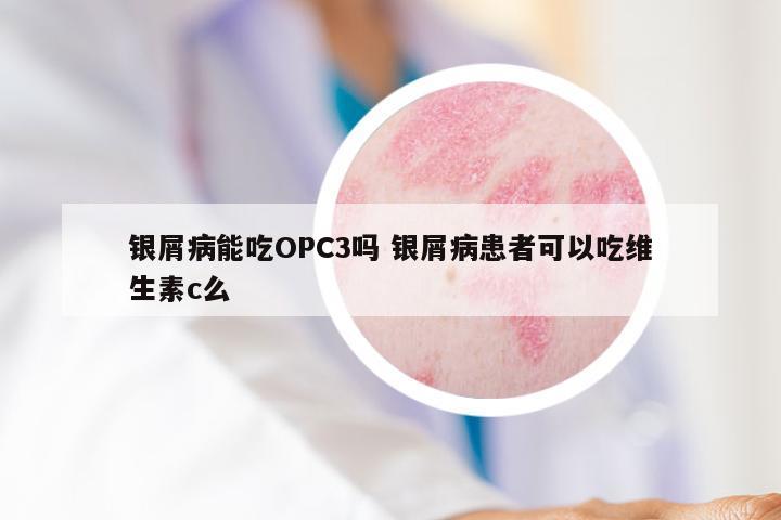 银屑病能吃OPC3吗 银屑病患者可以吃维生素c么
