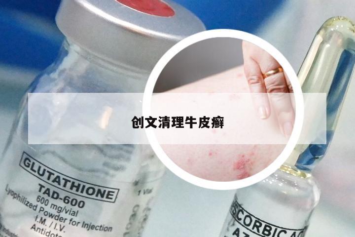 创文清理牛皮癣