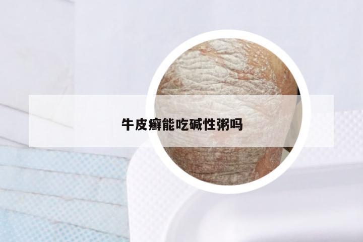 牛皮癣能吃碱性粥吗