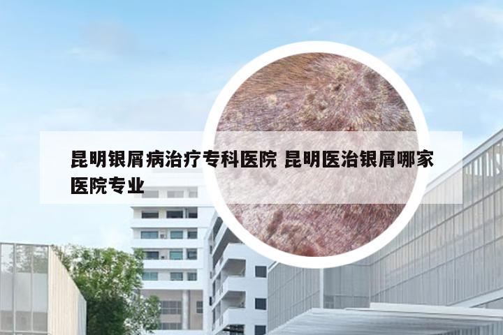 昆明银屑病治疗专科医院 昆明医治银屑哪家医院专业