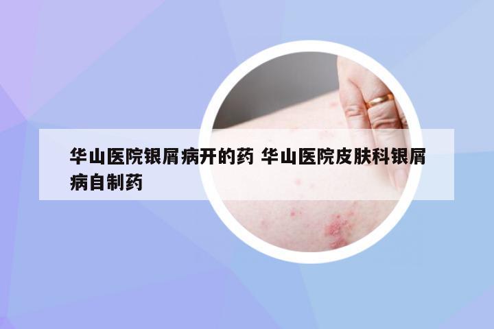 华山医院银屑病开的药 华山医院皮肤科银屑病自制药