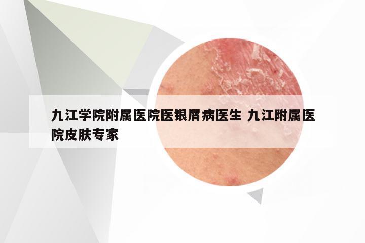 九江学院附属医院医银屑病医生 九江附属医院皮肤专家