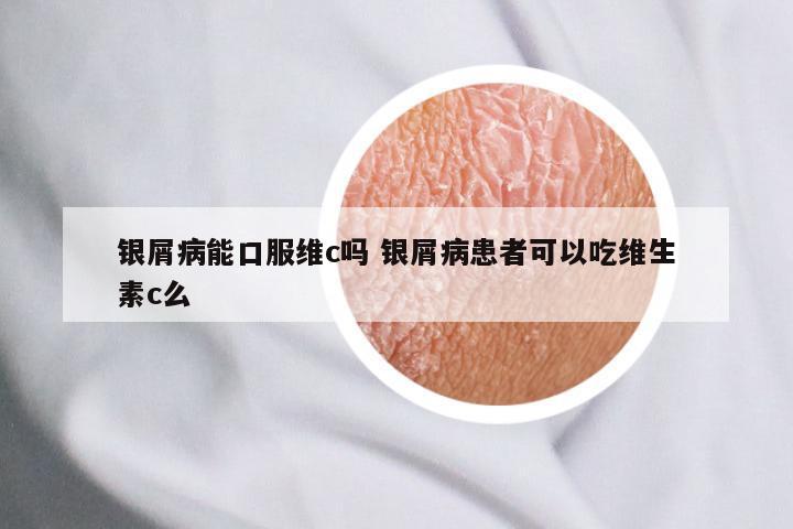 银屑病能口服维c吗 银屑病患者可以吃维生素c么