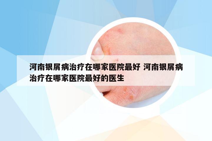 河南银屑病治疗在哪家医院最好 河南银屑病治疗在哪家医院最好的医生