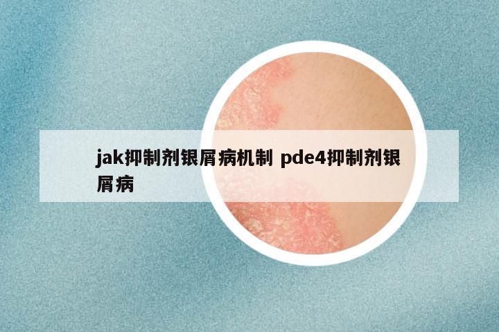 jak抑制剂银屑病机制 pde4抑制剂银屑病
