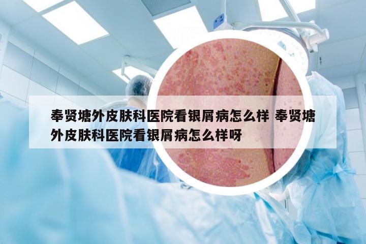 奉贤塘外皮肤科医院看银屑病怎么样 奉贤塘外皮肤科医院看银屑病怎么样呀