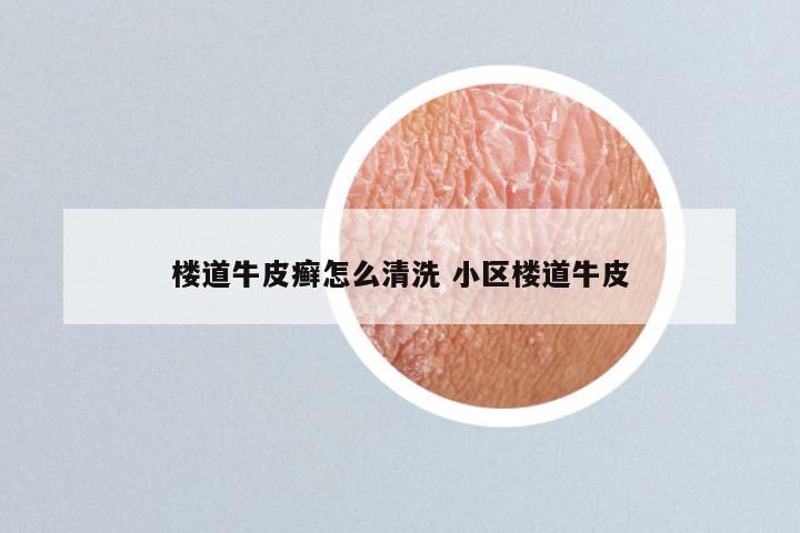 楼道牛皮癣怎么清洗 小区楼道牛皮