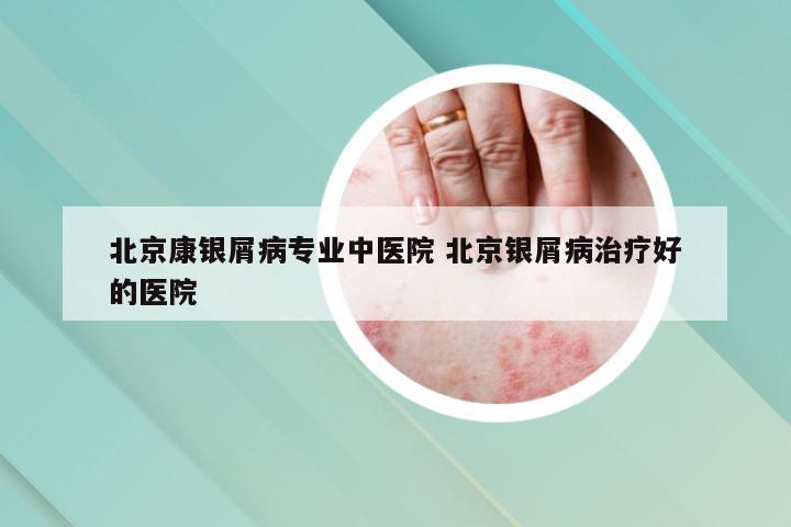 北京康银屑病专业中医院 北京银屑病治疗好的医院