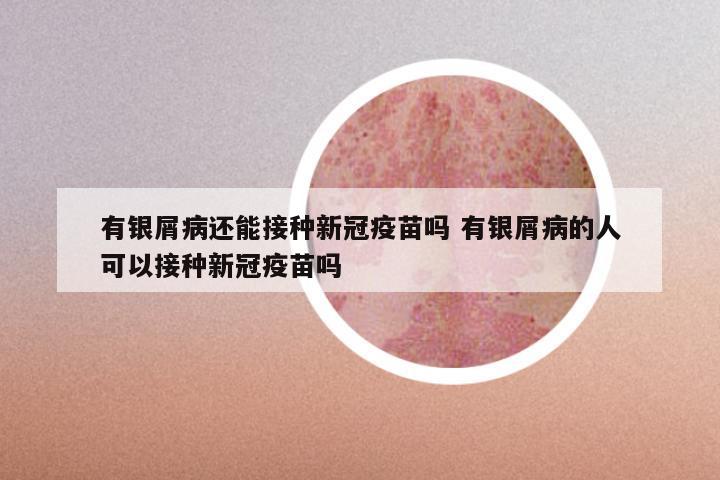 有银屑病还能接种新冠疫苗吗 有银屑病的人可以接种新冠疫苗吗