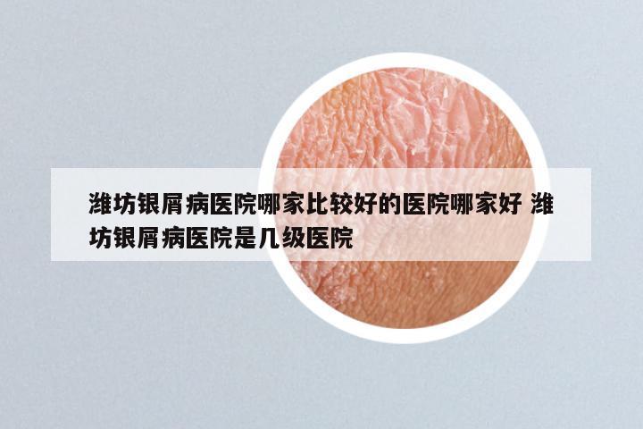 潍坊银屑病医院哪家比较好的医院哪家好 潍坊银屑病医院是几级医院
