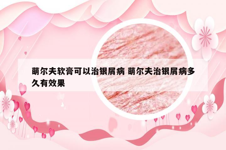 萌尔夫软膏可以治银屑病 萌尔夫治银屑病多久有效果