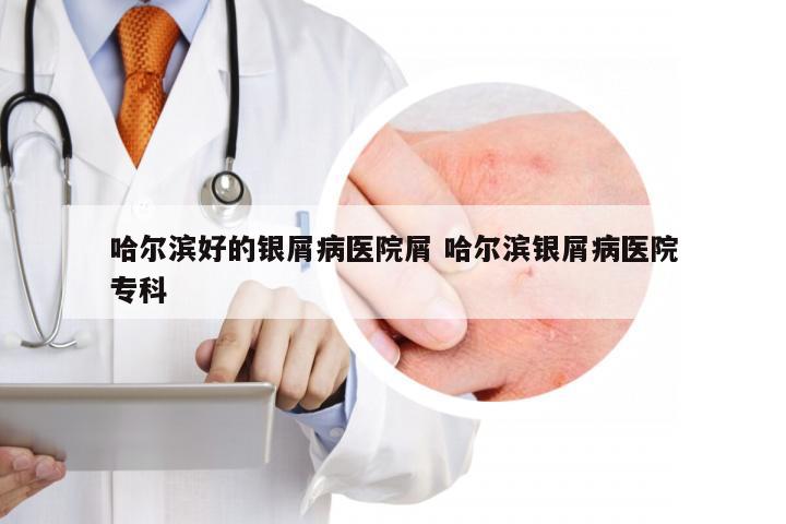 哈尔滨好的银屑病医院屑 哈尔滨银屑病医院专科