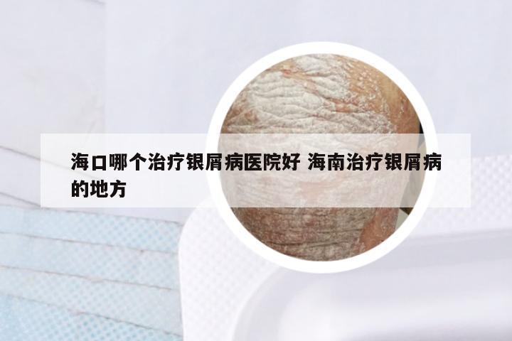 海口哪个治疗银屑病医院好 海南治疗银屑病的地方