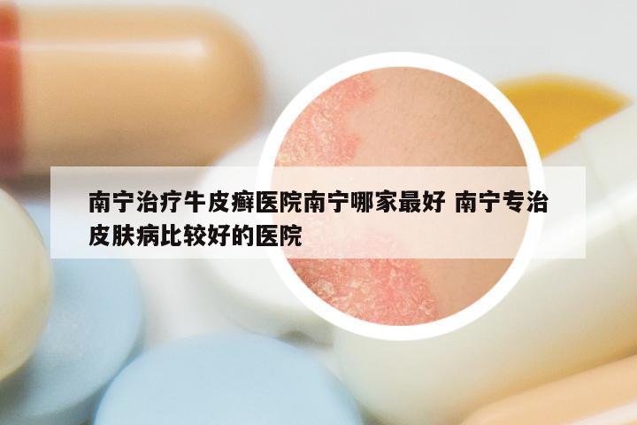 南宁治疗牛皮癣医院南宁哪家最好 南宁专治皮肤病比较好的医院