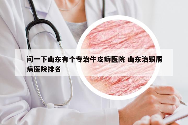 问一下山东有个专治牛皮癣医院 山东治银屑病医院排名