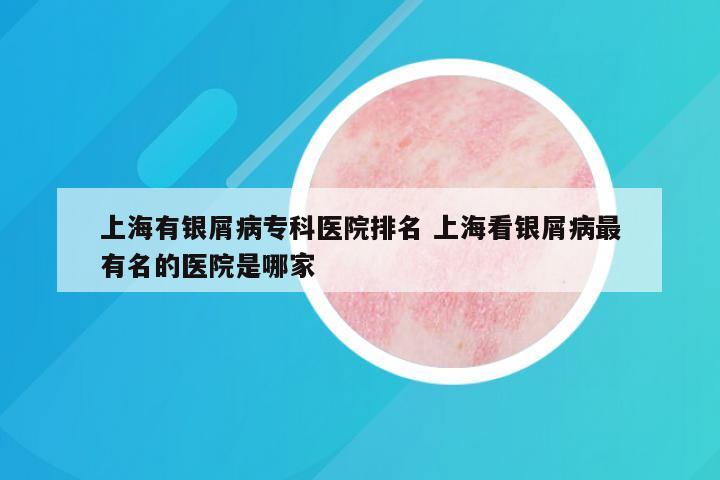 上海有银屑病专科医院排名 上海看银屑病最有名的医院是哪家