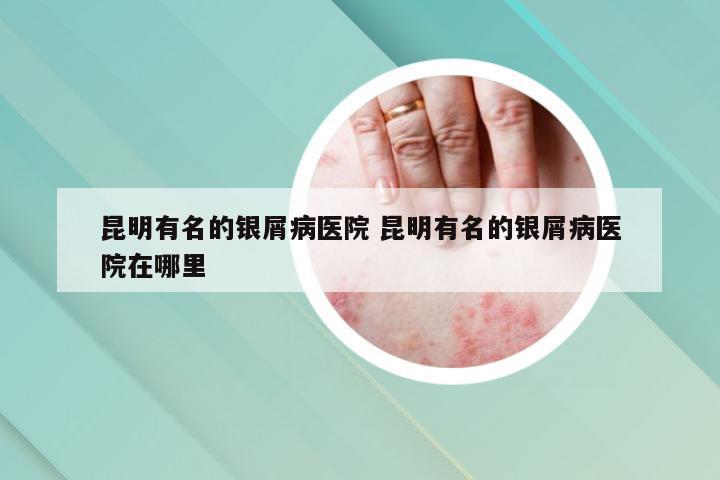 昆明有名的银屑病医院 昆明有名的银屑病医院在哪里