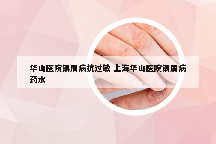 华山医院银屑病抗过敏 上海华山医院银屑病药水