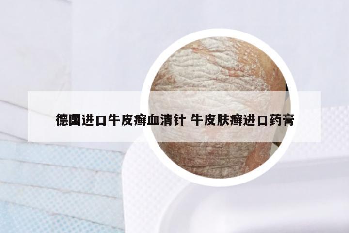 德国进口牛皮癣血清针 牛皮肤癣进口药膏