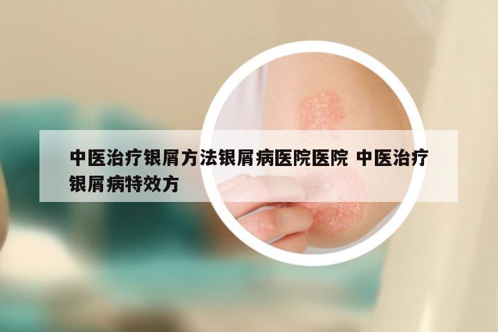 中医治疗银屑方法银屑病医院医院 中医治疗银屑病特效方
