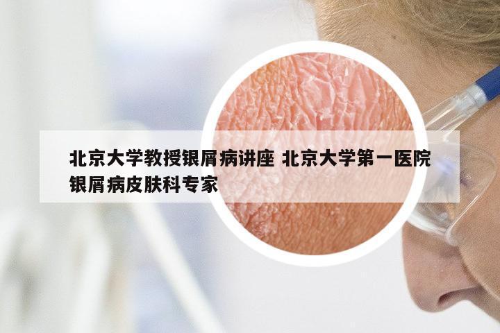北京大学教授银屑病讲座 北京大学第一医院银屑病皮肤科专家