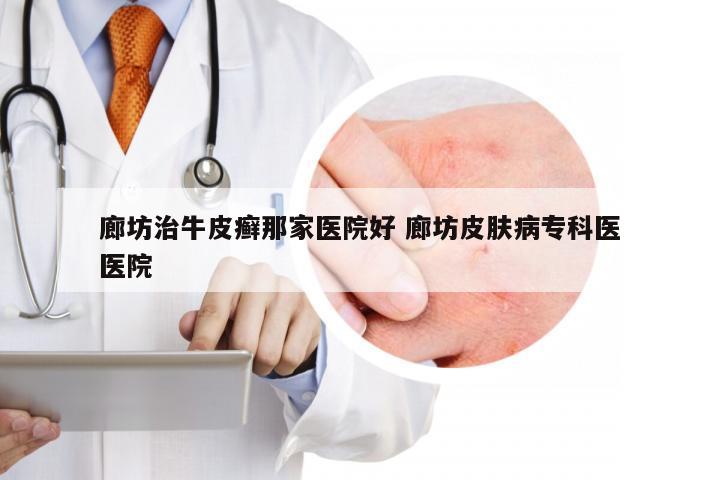 廊坊治牛皮癣那家医院好 廊坊皮肤病专科医医院
