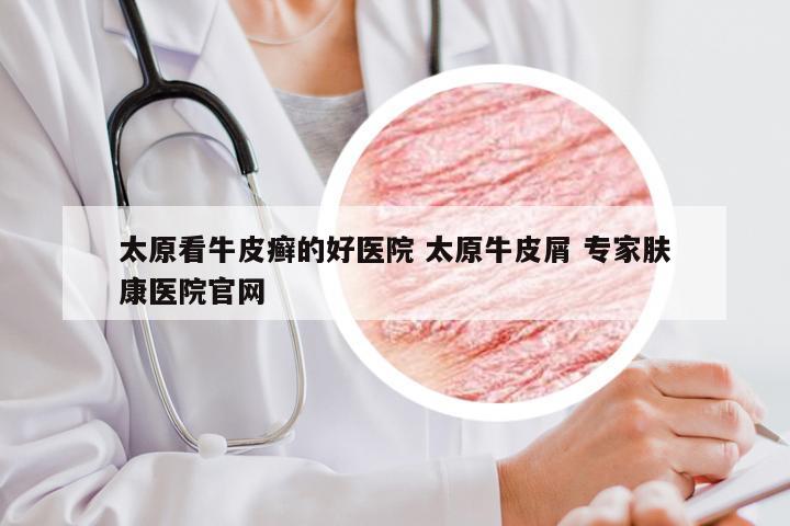 太原看牛皮癣的好医院 太原牛皮屑 专家肤康医院官网