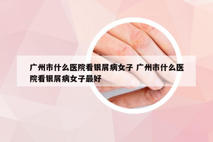 广州市什么医院看银屑病女子 广州市什么医院看银屑病女子最好