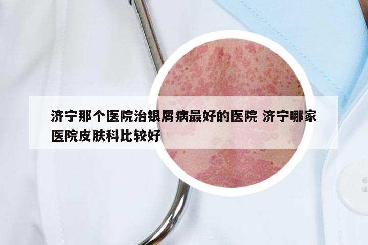 济宁那个医院治银屑病最好的医院 济宁哪家医院皮肤科比较好