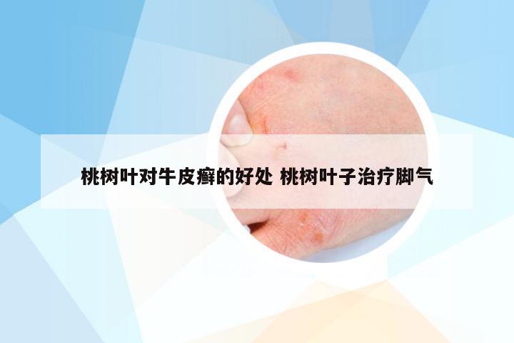 桃树叶对牛皮癣的好处 桃树叶子治疗脚气