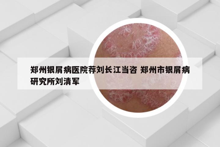 郑州银屑病医院荐刘长江当咨 郑州市银屑病研究所刘清军