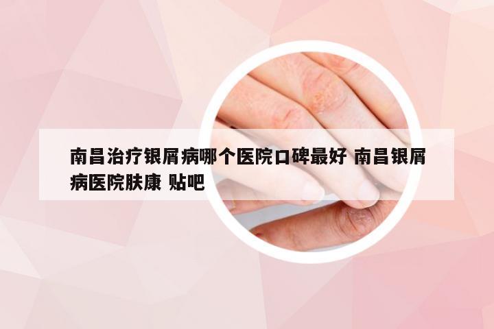 南昌治疗银屑病哪个医院口碑最好 南昌银屑病医院肤康 贴吧
