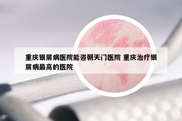 重庆银屑病医院能咨朝天门医院 重庆治疗银屑病最高的医院