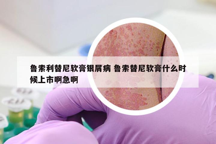 鲁索利替尼软膏银屑病 鲁索替尼软膏什么时候上市啊急啊