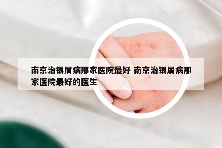 南京治银屑病那家医院最好 南京治银屑病那家医院最好的医生