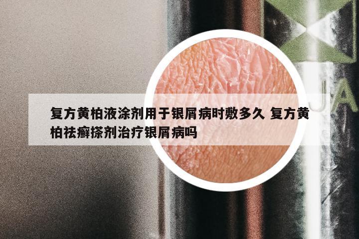 复方黄柏液涂剂用于银屑病时敷多久 复方黄柏祛癣搽剂治疗银屑病吗