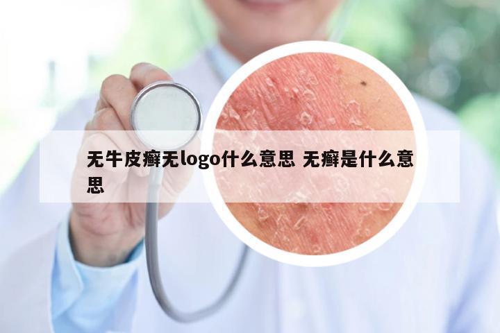 无牛皮癣无logo什么意思 无癣是什么意思